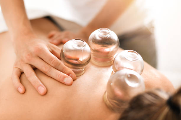woman receiving cupping therapy